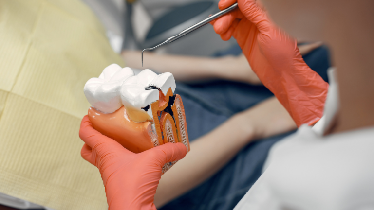 endodoncista en Houston explica tratamiento de conducto