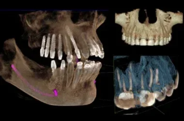 Radiología oral 3D en Houston Texas