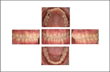 Fotografía digital clínica intraoral y extraoral