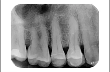 Radiología oral para imagen periapical